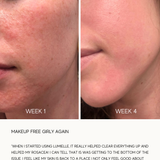 Glass Skin Liquid Exfoliant