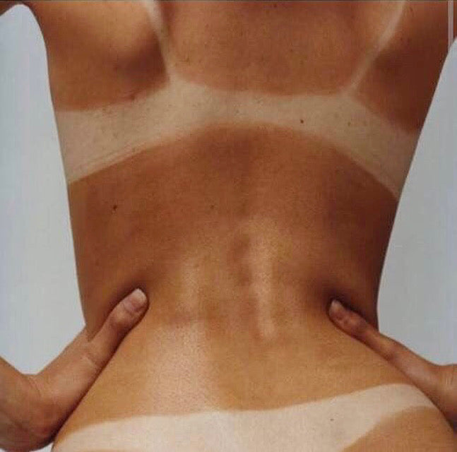 The Balancing Act of Sun Exposure